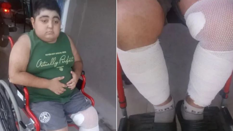 Caucete: Lisandro la sigue peleando, gasta $80.000 por mes en una crema
