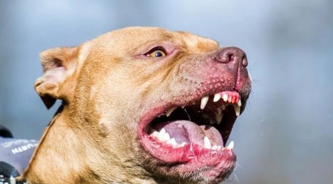 25 de Mayo: una mujer fue atacada por un pitbull, perdió mucha sangre y fue operada