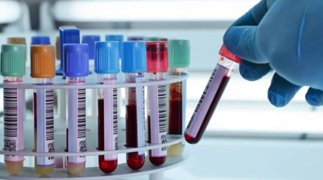 Bioquímicos sanjuaninos ya cobran un plus de $3.000 para atenciones de la mayoría de las prepagas