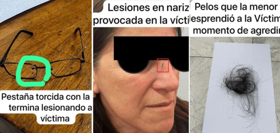 25 de Mayo: así quedó la directora, tras la agresión de madre e hija