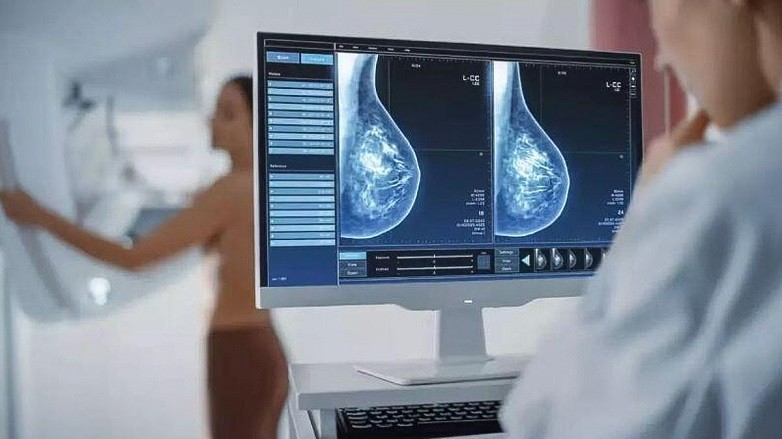La importancia de la mamografía