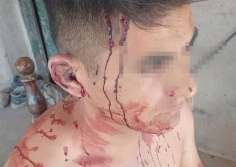 Un grupo armado vestido de federales irrumpió en una casa, golpeó al dueño y escapó con dinero