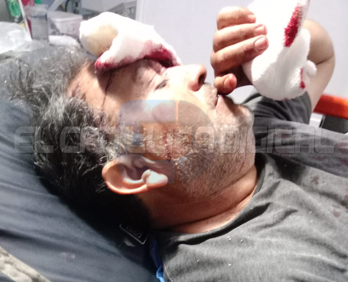 Caucete: un violento ataque con una pala, deja en terapia a un hombre y peleando por su vida