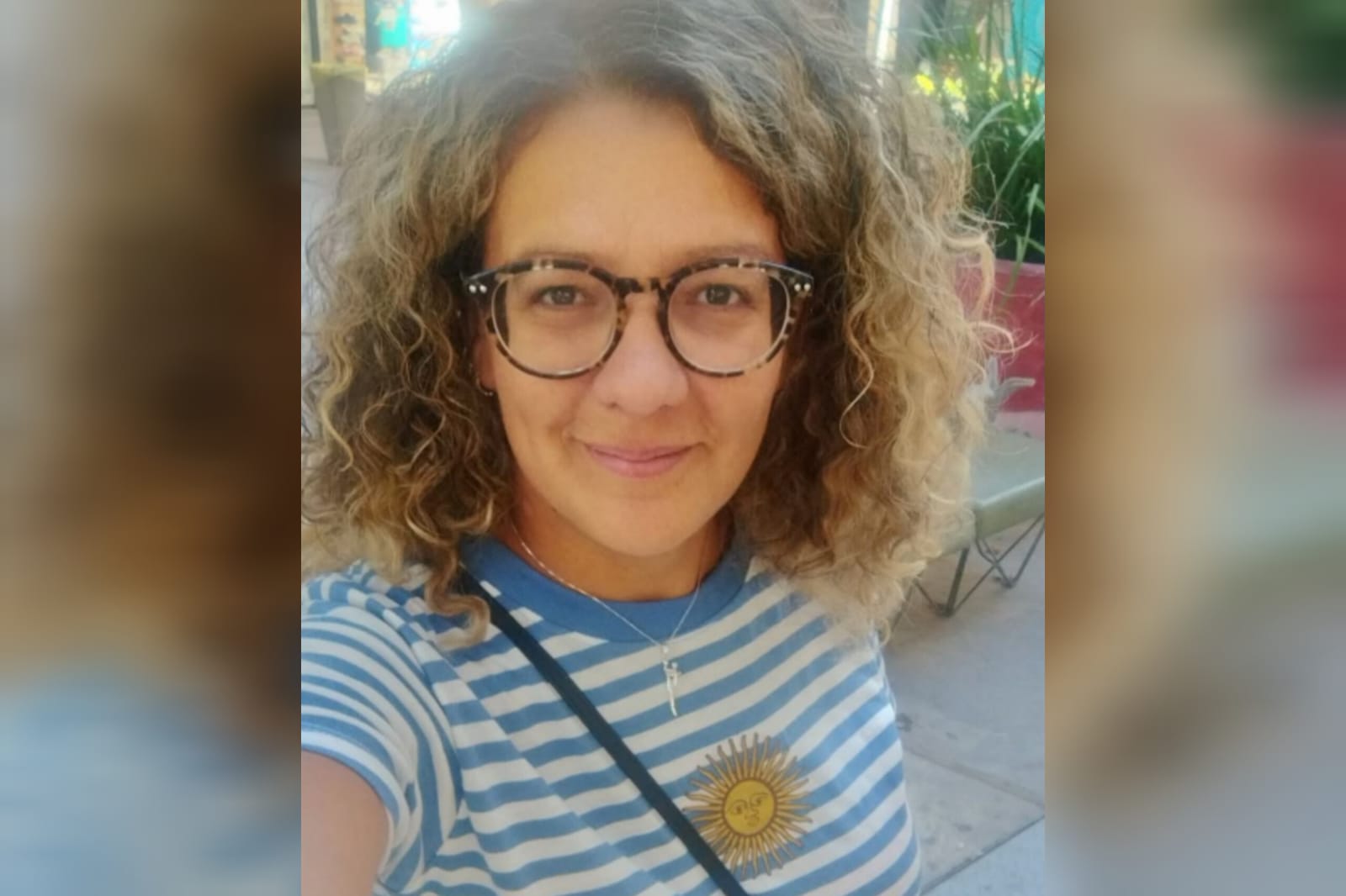Caucete: murió la mujer que sufrió quemaduras en su cuerpo