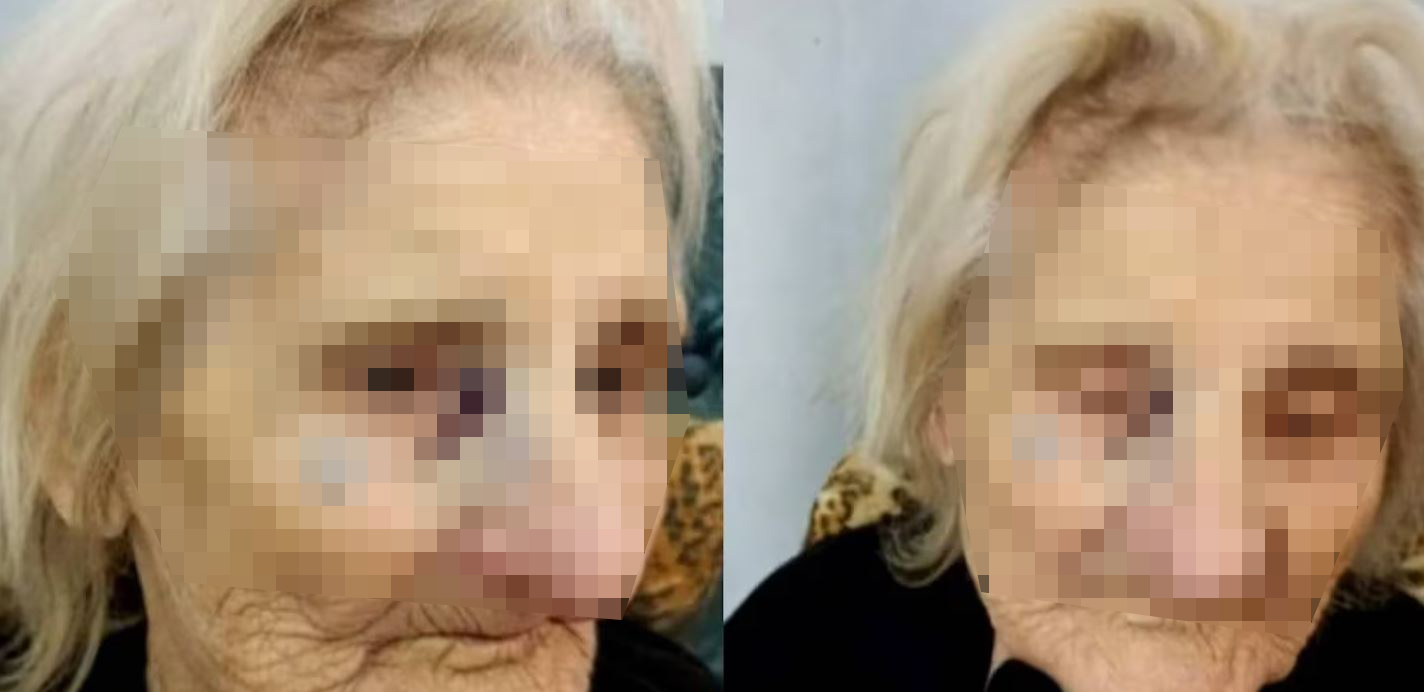 San Martín: una jubilada de 91 años fue atacada con un hacha durante un asalto en su casa